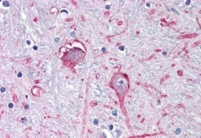 Immunohistochemistry-Paraffin: GABA-AR alpha 3 Antibody [NBP3-14326] - Immunohistochemistry of formalin-fixed, paraffin-embedded human brain, globus pallidus, after heat-induced antigen retrieval.